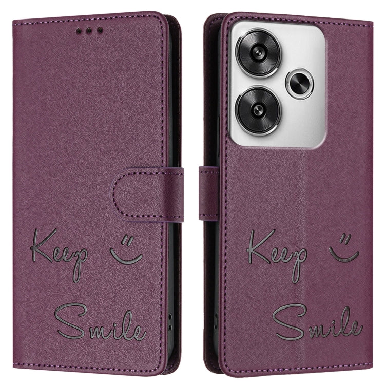 EDA007075601F_2.jpg@76e6823afbeb515139c5c49a942f7616